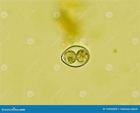  Isospora!  A Tiny Parasite With An Enormous Impact On Mammalian Gut Health