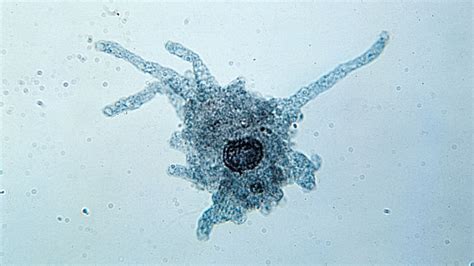  Zoomobryomyces! En fascinerande Amoebozoa som simmar med hjälp av pseudopoder och är ett mästare på att konsumera bakterier.