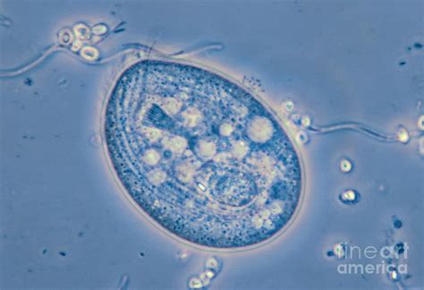 Chilodonella! Den lilla cilierade organismen som är en mästare på att filtrera och konsumera bakterier